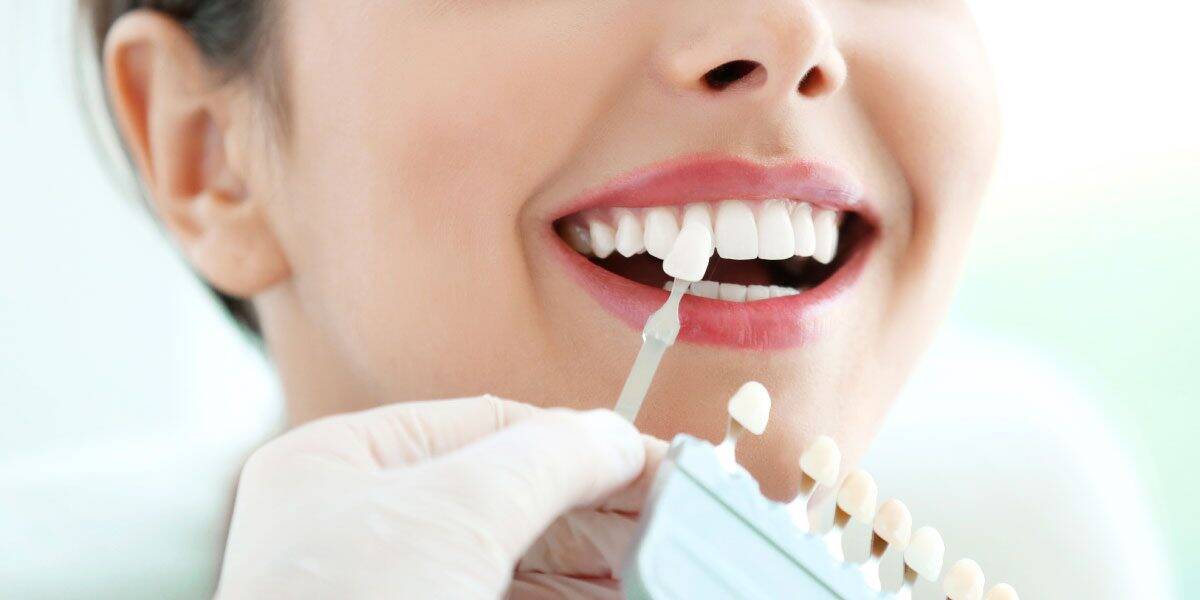 how-are-dental-crowns-used A dentist holds a tooth shade guide next to a woman's teeth to compare color for a dental procedure.