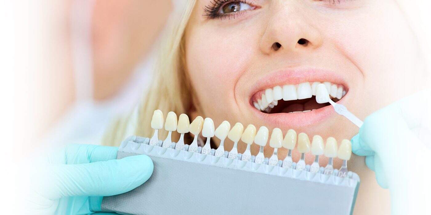 Tooth-Colored Fillings Prevent Tooth Decay