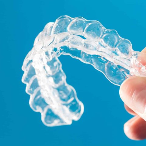 Invisalign vs Smile Direct Club