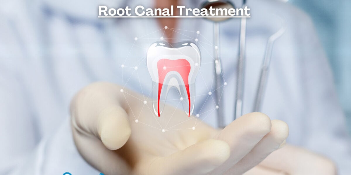 Root Canal Treatment