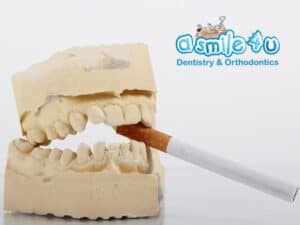 The Ultimate Guide to Maintaining Healthy Teeth