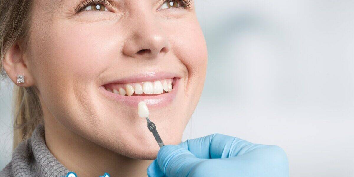 Porcelain Veneer Restoration