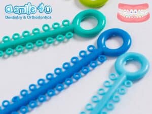 Braces Colors : Why Is It Important to Choose Them?