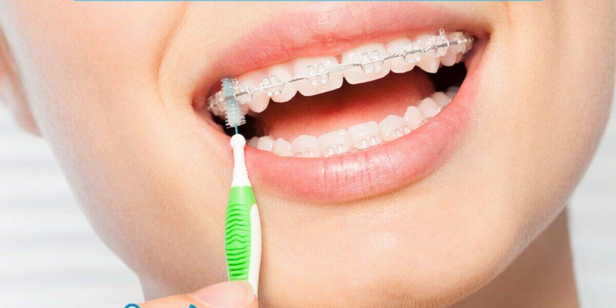 orthodontics for adults in cartersville