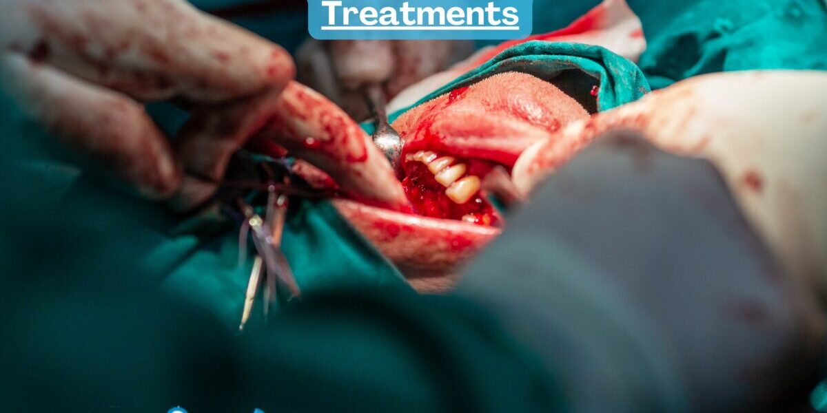 Jaw Tumors and Cysts: Causes and Treatments Jaw Tumors and Cysts: Causes and Treatments