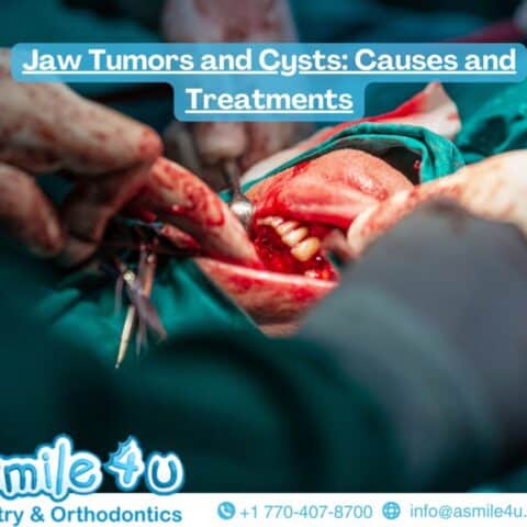Jaw Tumors and Cysts: Causes and Treatments