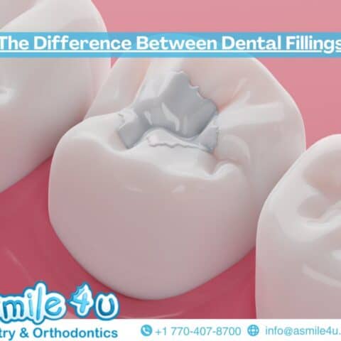 The Difference Between Dental Fillings