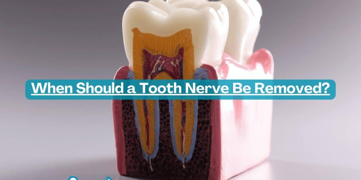 When Should a Tooth Nerve Be Removed?