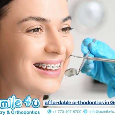 affordable orthodontics in Georgia