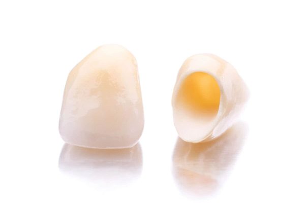 Dental-crowns-in-Dalton-GA-over-white-surface