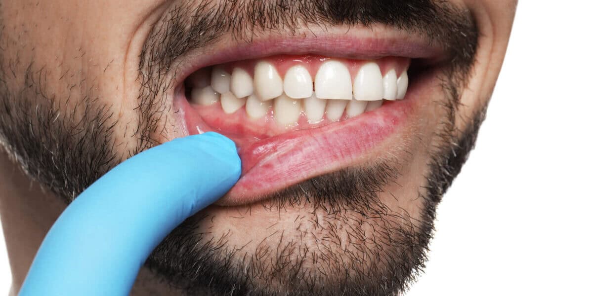 Dentist east point ga showing healthy gums