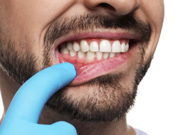 Dentist-east-point-ga-showing-healthy-gums Dentist east point ga showing healthy gums