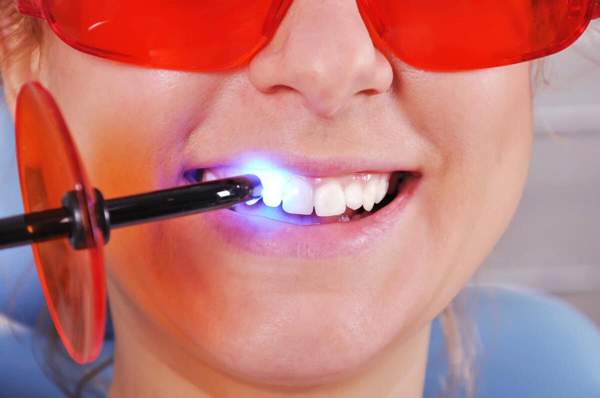 comprehensive tooth filling services
