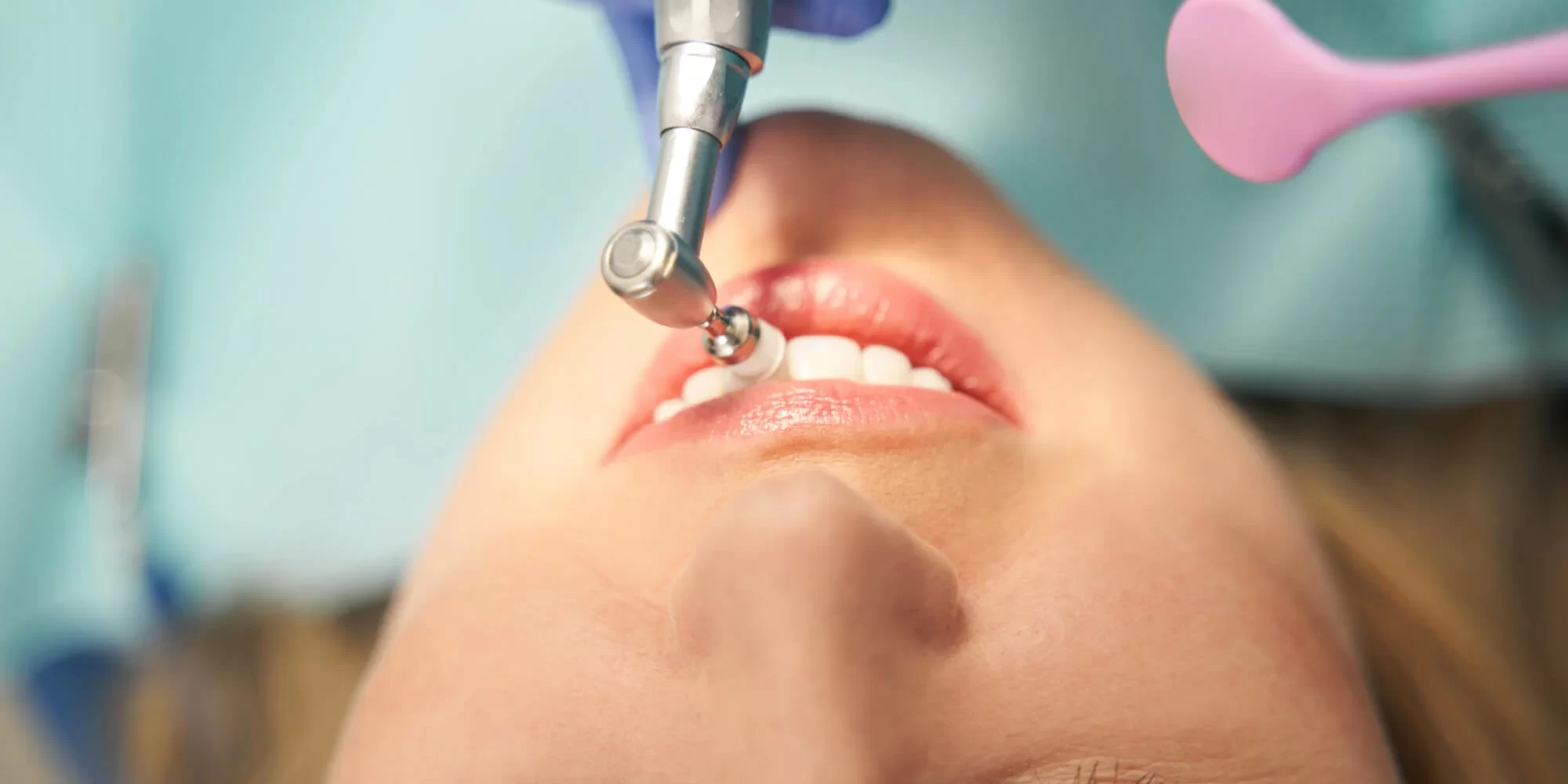 getting-Trusted-Dental-Hygiene-Services